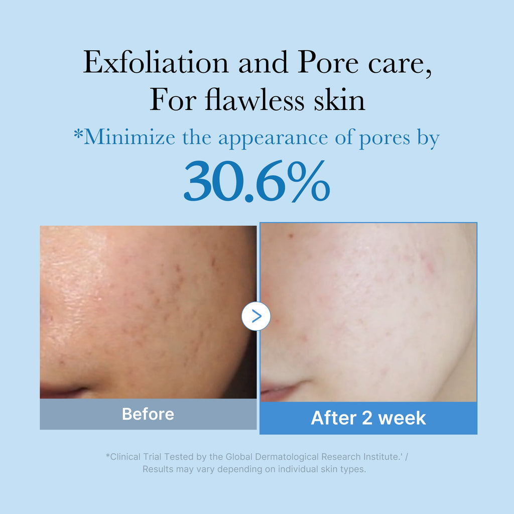 Zero Pore Toner - Daily Cream Cleanser