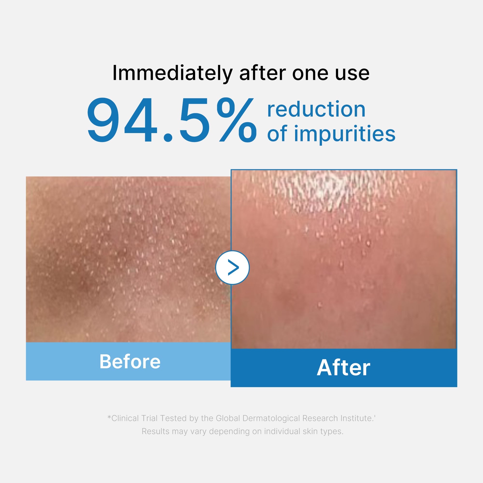 [Subscr.] Zero Pore Blackhead Deep Cleansing Oil - Beauty Drawer Moisture Cream