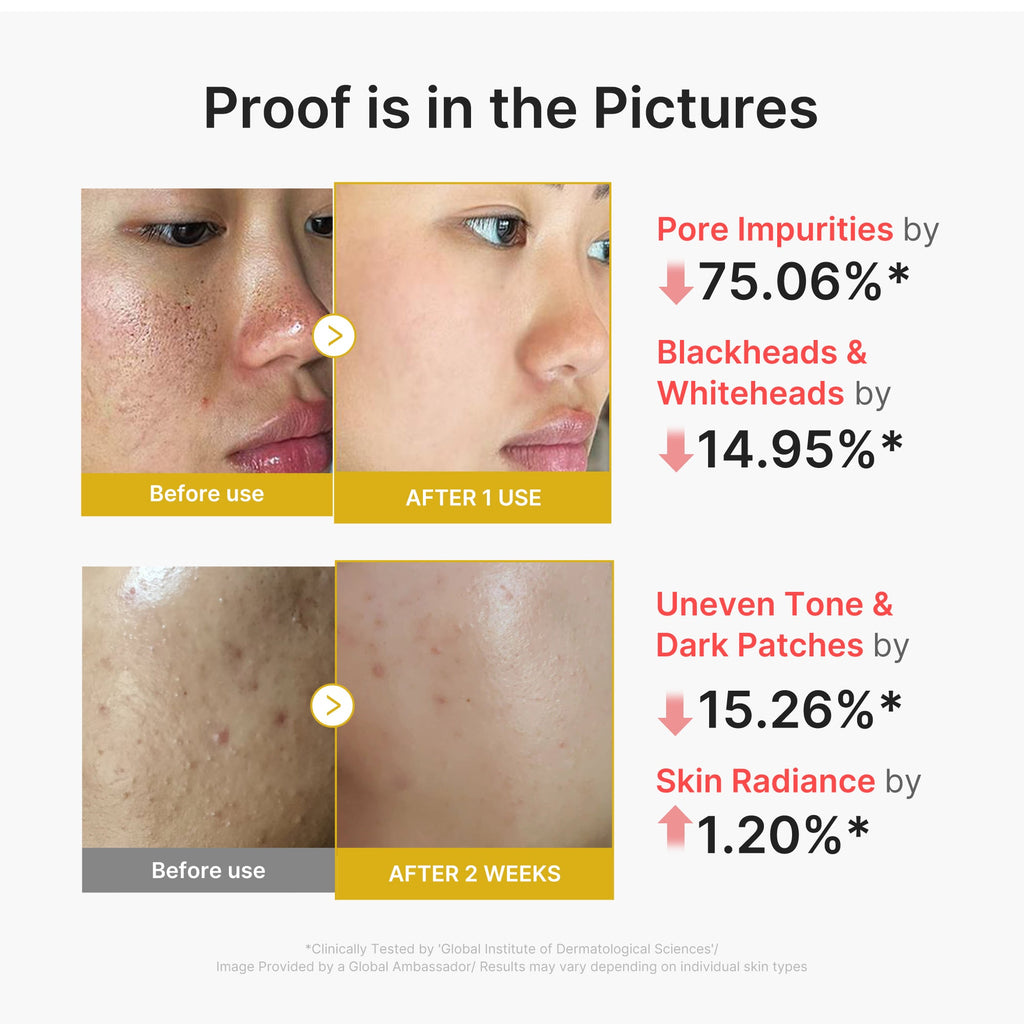 Kojic Acid Turmeric Peel Shot - Glow Ready Moisture Cream