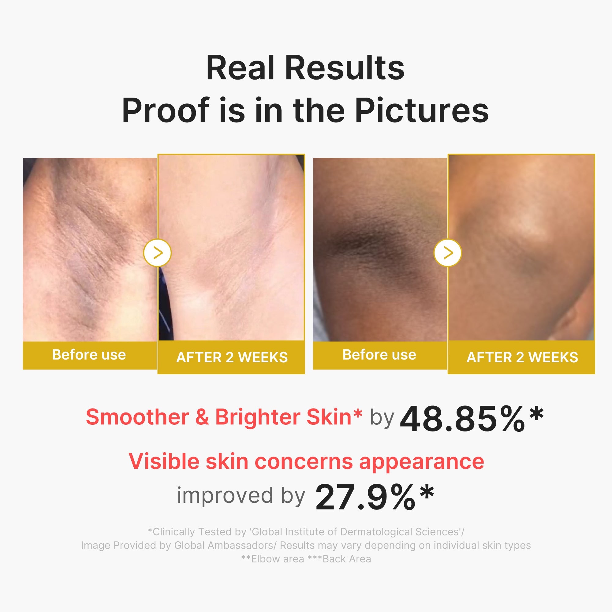 Kojic Acid Turmeric Body Peel Shot - Dewy Cleansing Balm