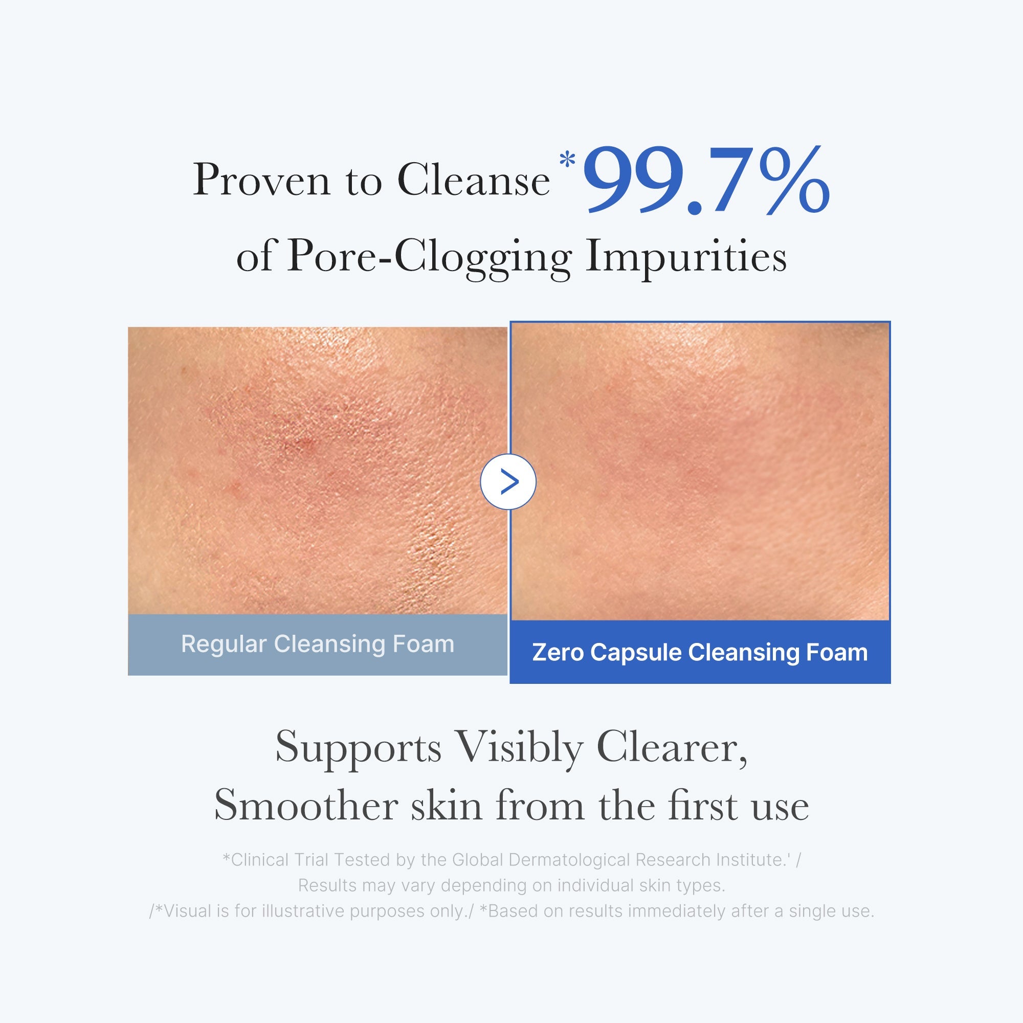 Zero Pore Capsule Cleansing Foam - Dewy Night Cream