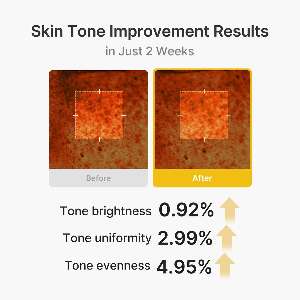 Kojic Acid Turmeric Vita Capsule Cream - Dewy Gel Cleanser