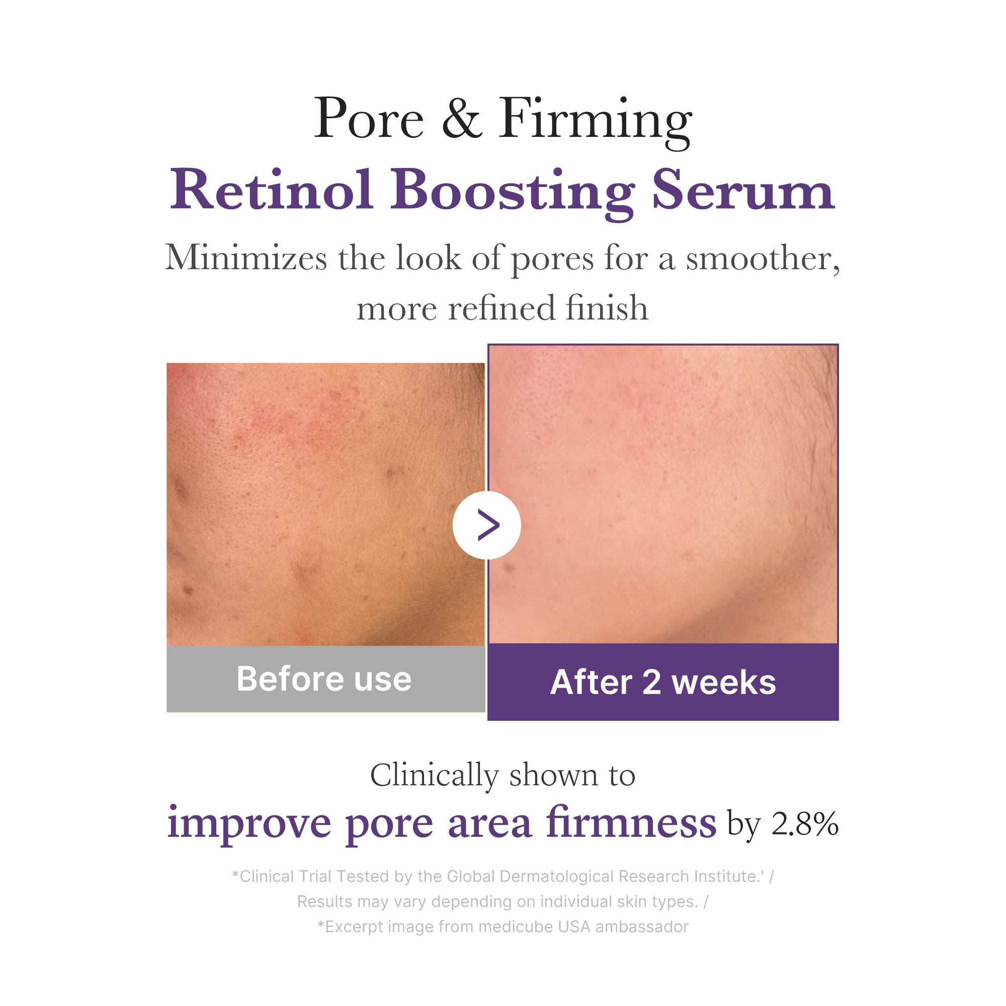 Retinol NMN Boosting Serum - Glow Ready Gel Cleanser