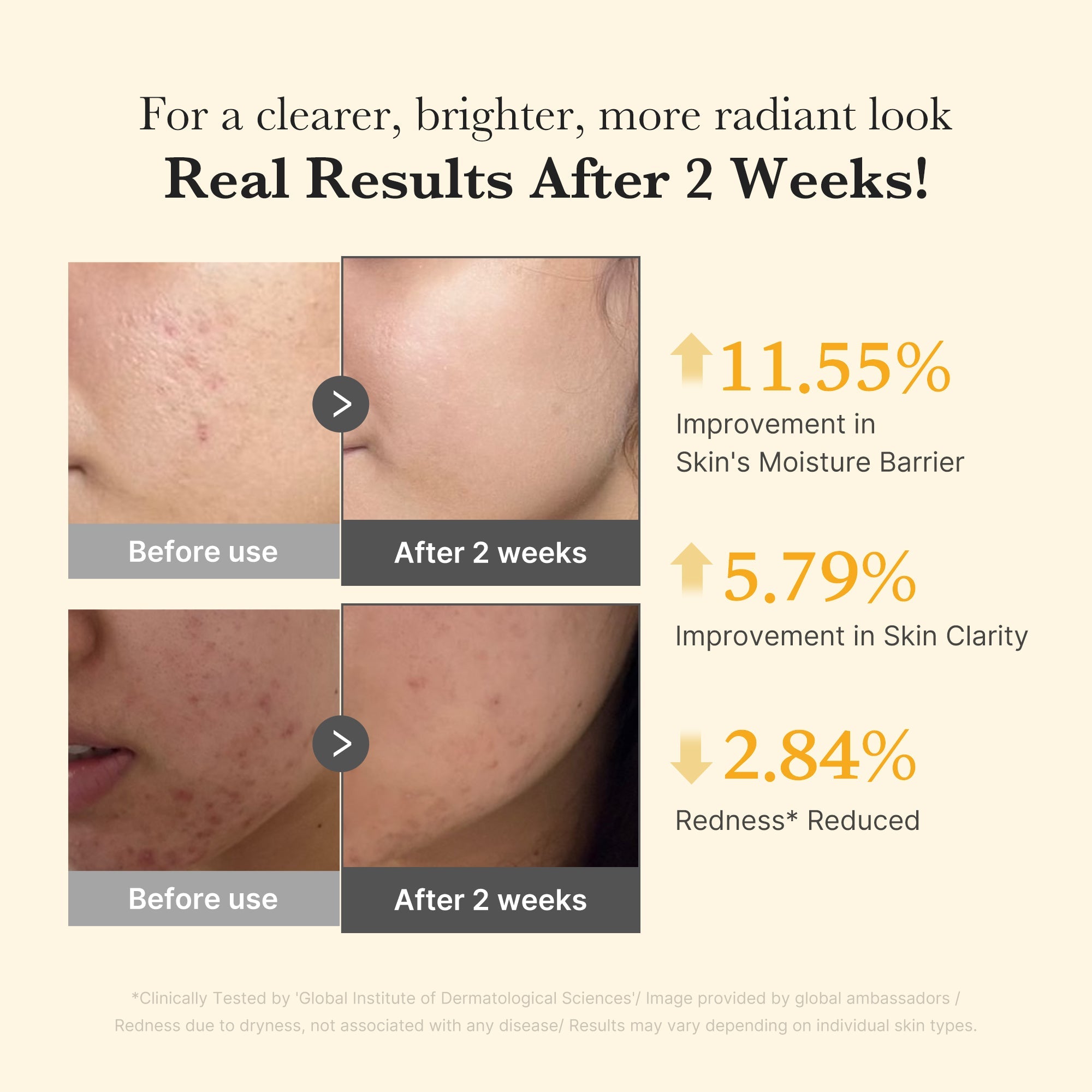 [GIFT] Kojic Acid Turmeric Capsule Serum - Travel Ready Cream Cleanser