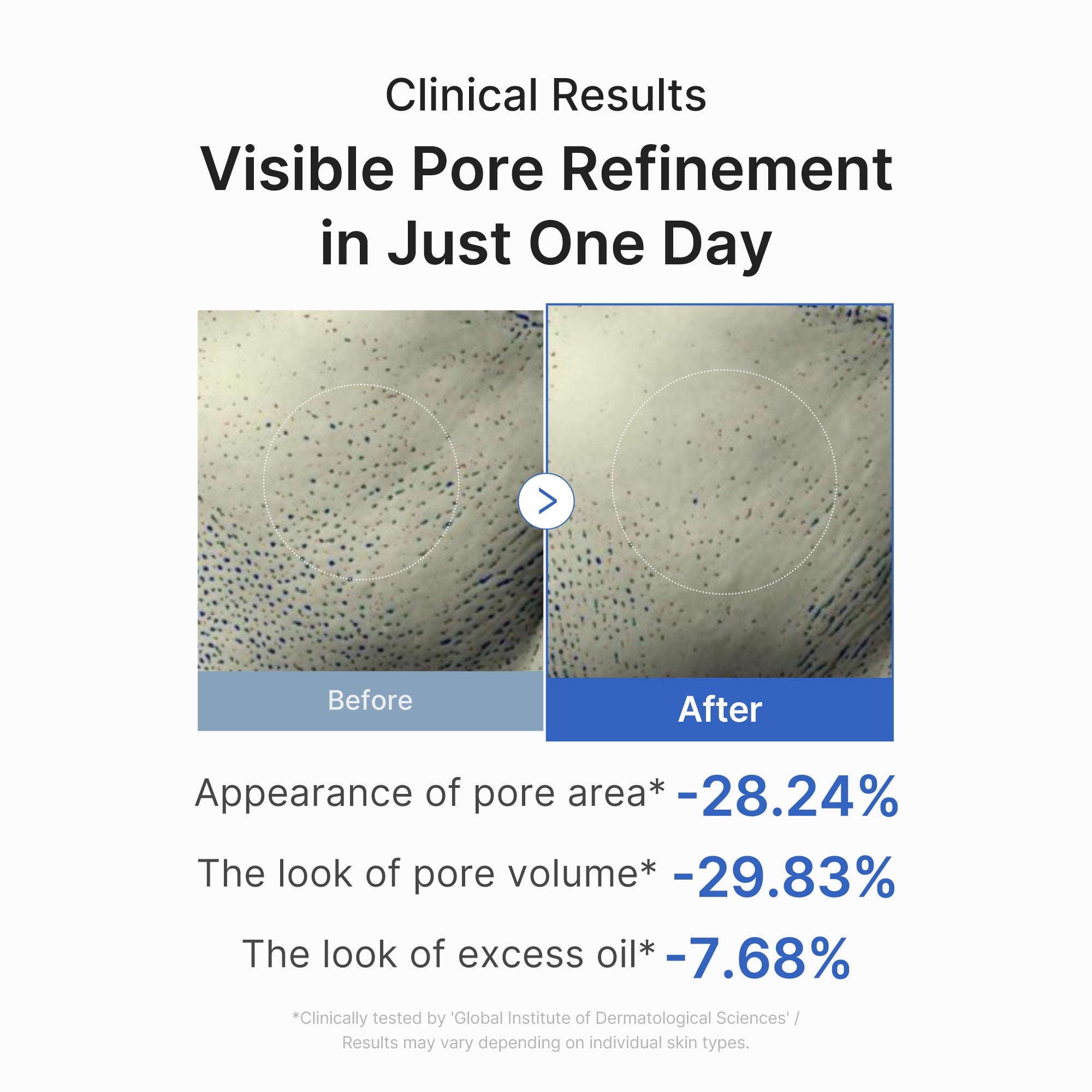 [Subscr.] Zero Pore One-day Peptide Serum - Dewy Pore Care