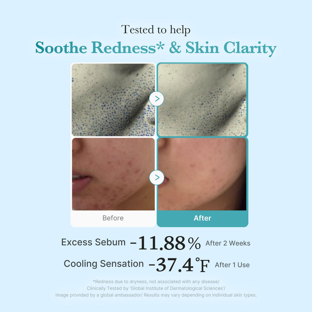 Azelaic Acid Niacinamide Clarifying Toner - Minimal Cleansing Balm