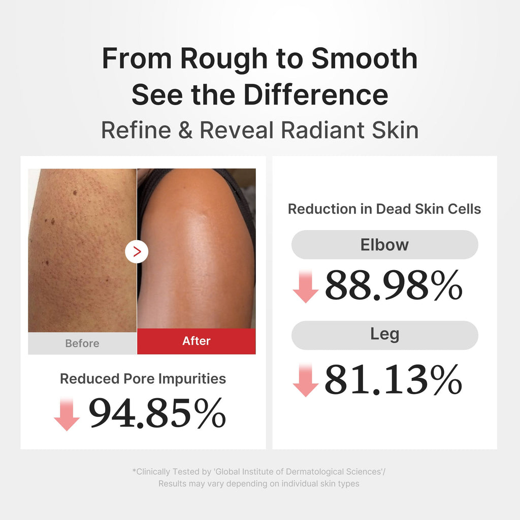 [GIFT] Hypochlorous Acid Rice Body Peel Shot - Modern Clay Mask