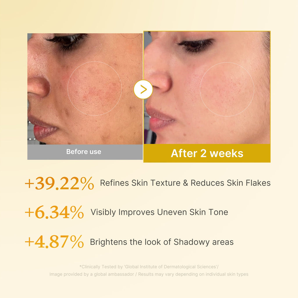 [GIFT] Kojic Acid Turmeric Toner - Dewy Facial Device