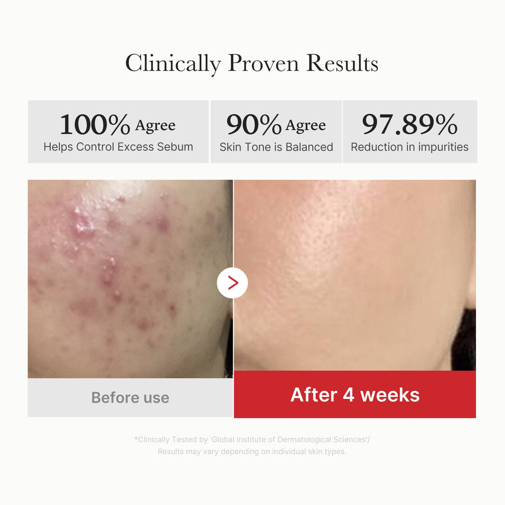 Red Succinic Acid Panthenol Pads - Travel Ready Facial Cream