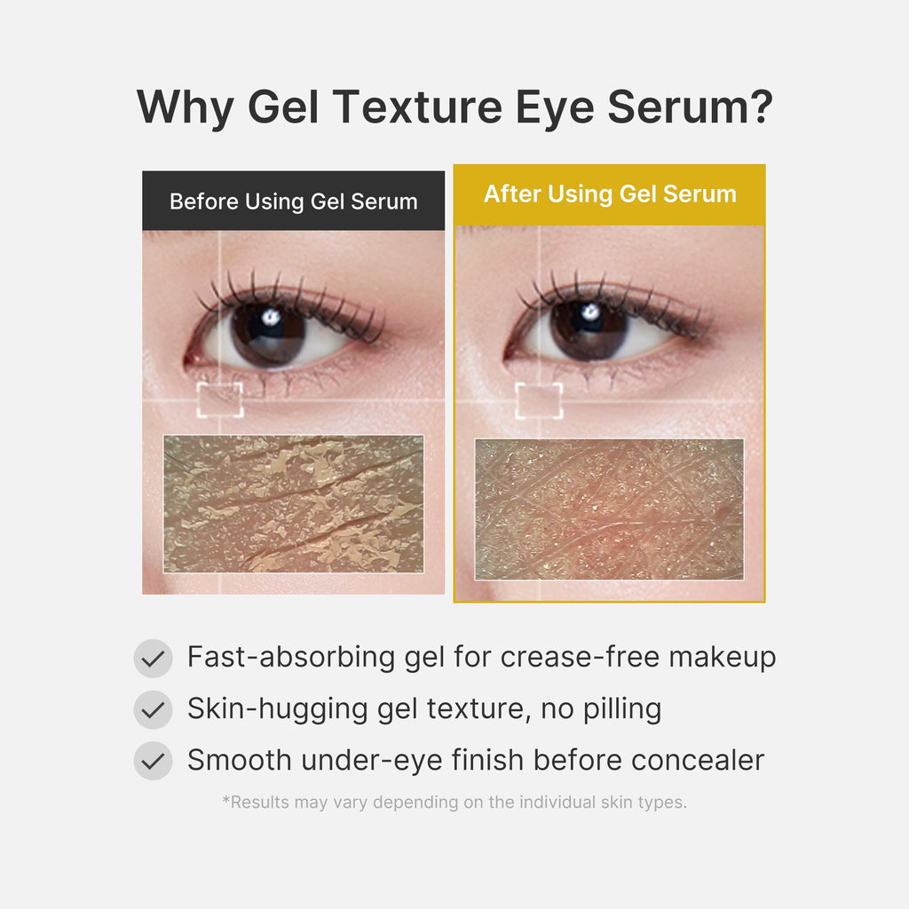 Kojic Acid Tumeric Eye Gel Serum - Lightweight Moisture Cream
