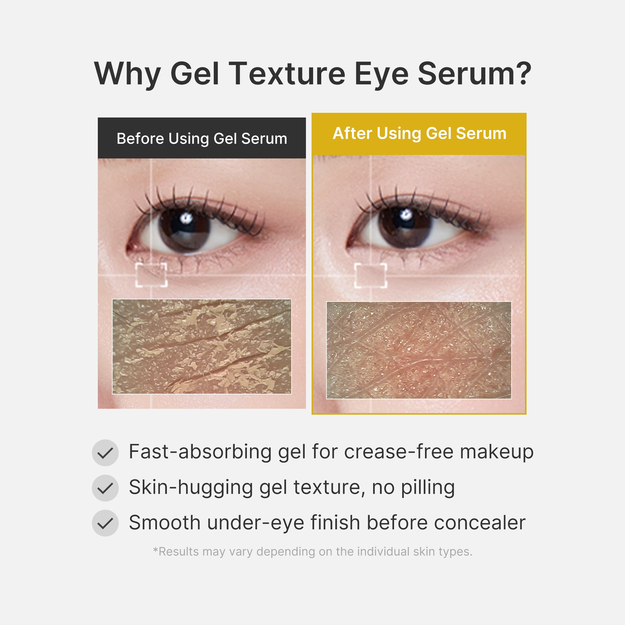 Kojic Acid Tumeric Eye Gel Serum - Lightweight Moisture Cream