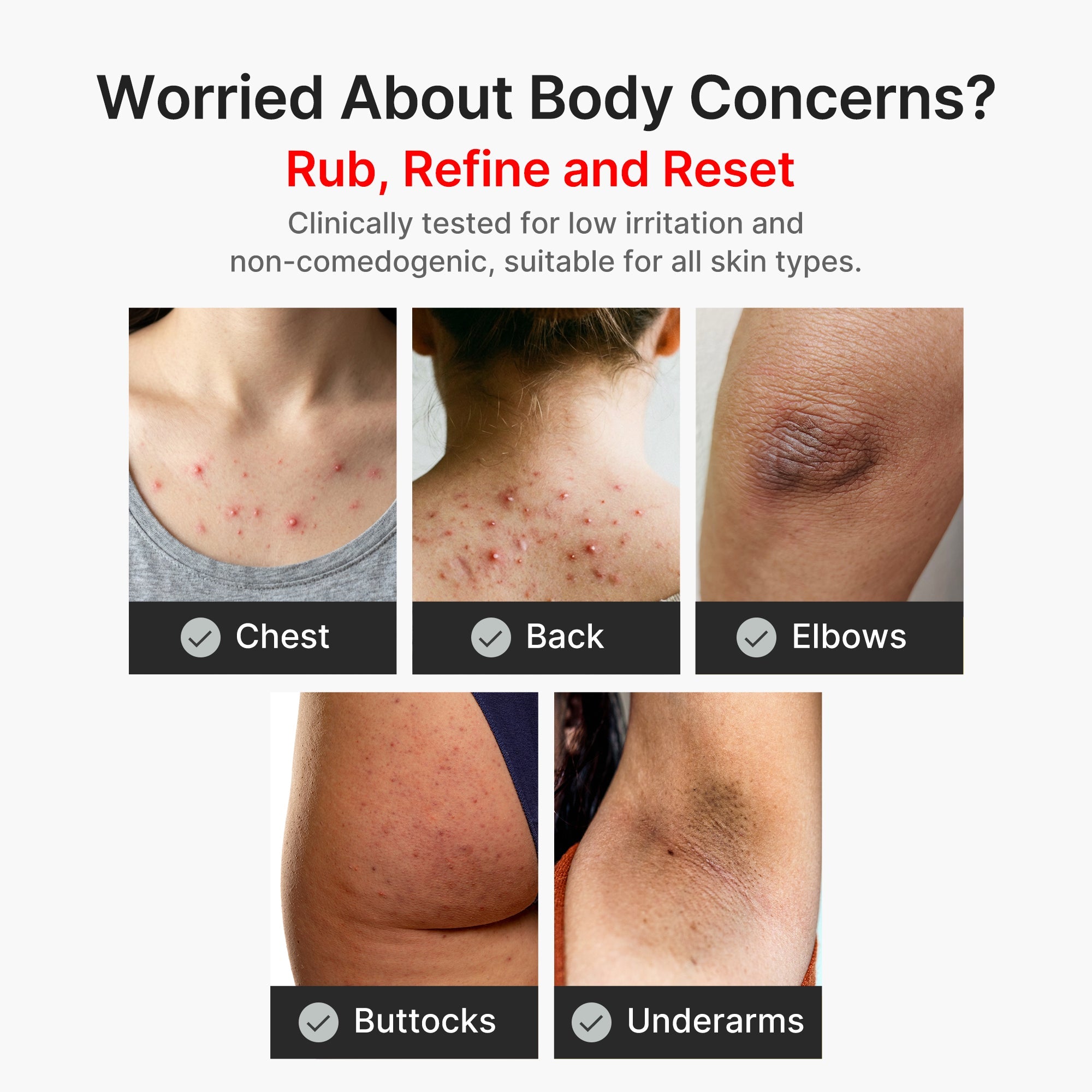 Kojic Acid Turmeric Body Peel Shot - Dewy Cleansing Balm