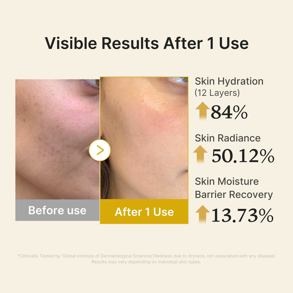 Kojic Acid Turmeric Vitamin Gold Jelly Mist Serum - Modern Skin Care Set