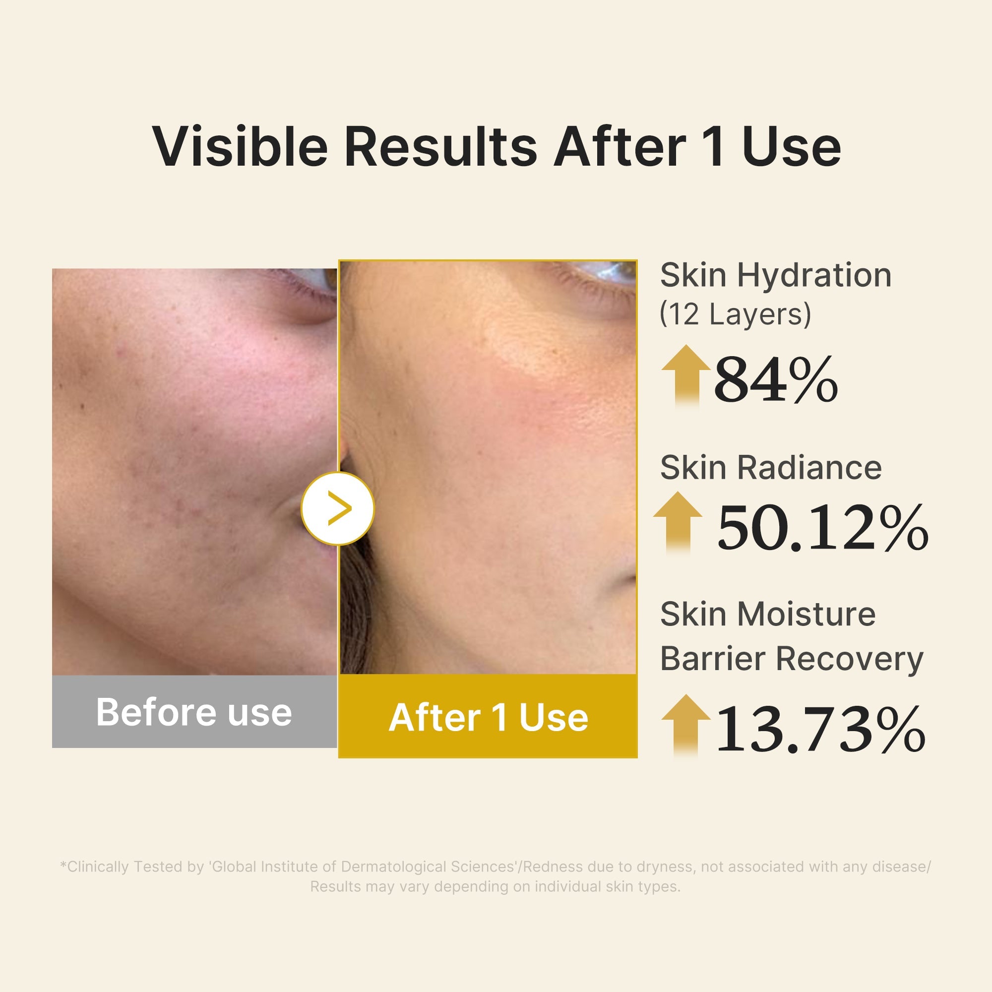 Kojic Acid Turmeric Vitamin Gold Jelly Mist Serum - Modern Skin Care Set