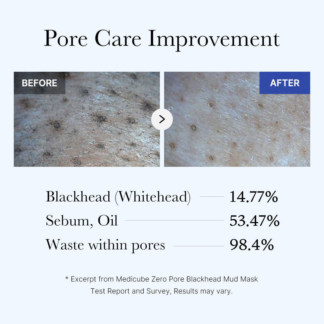 [Subscr.] Zero Pore Blackhead Mud Mask - Calm Look Gel Cleanser