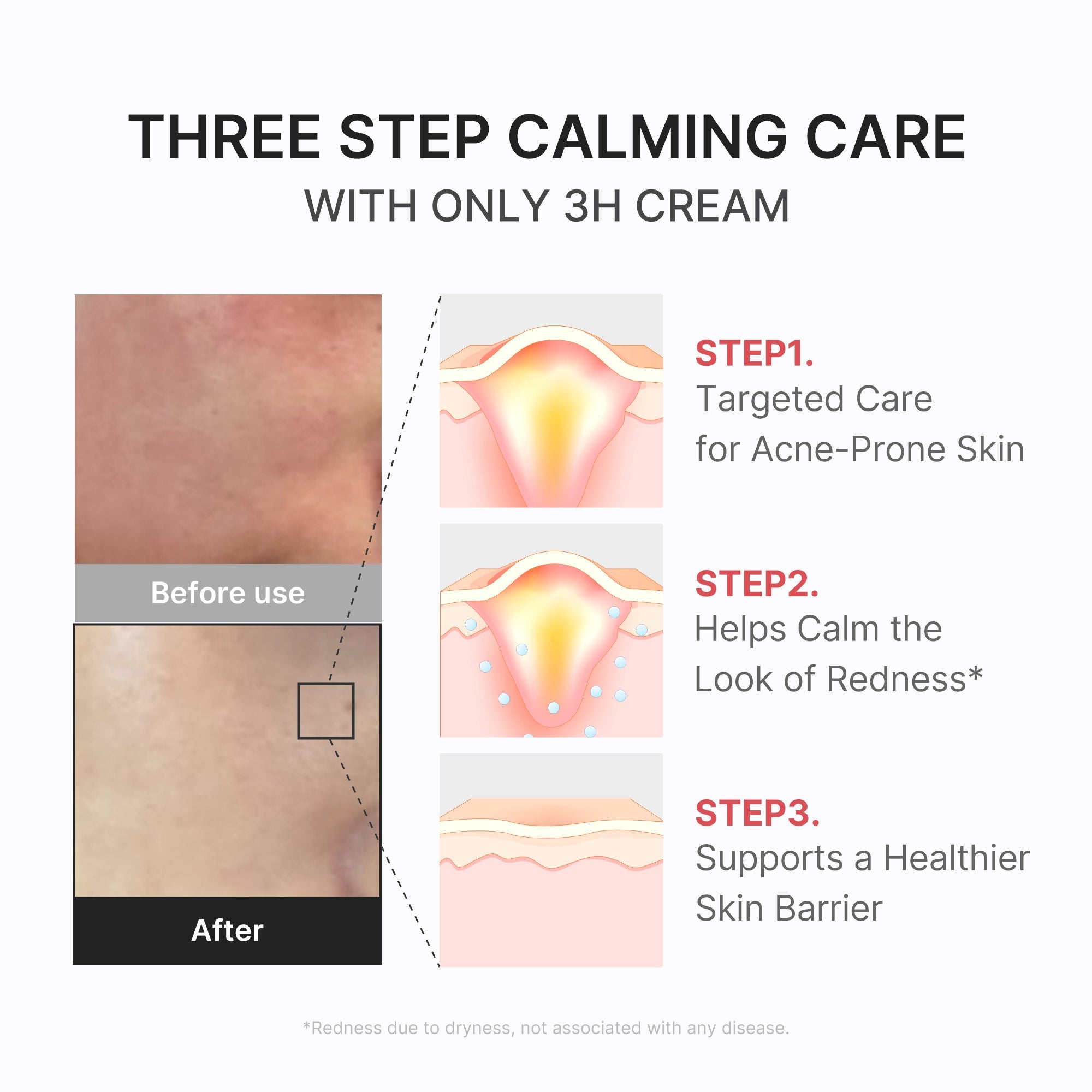 3H Daily Relief Cream - Travel Ready Cleansing Balm