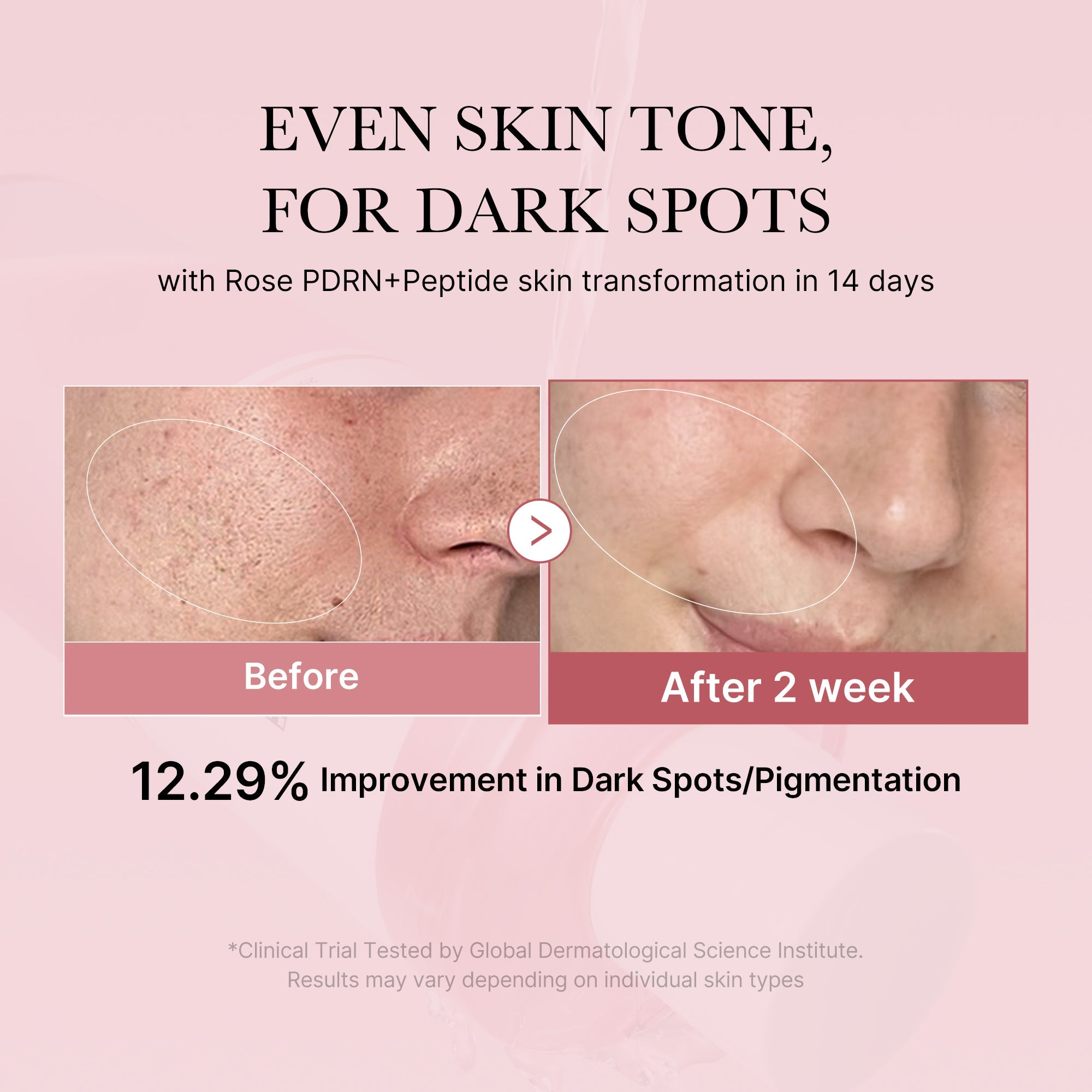 PDRN Pink Peptide Toner - Beauty Drawer Day Lotion