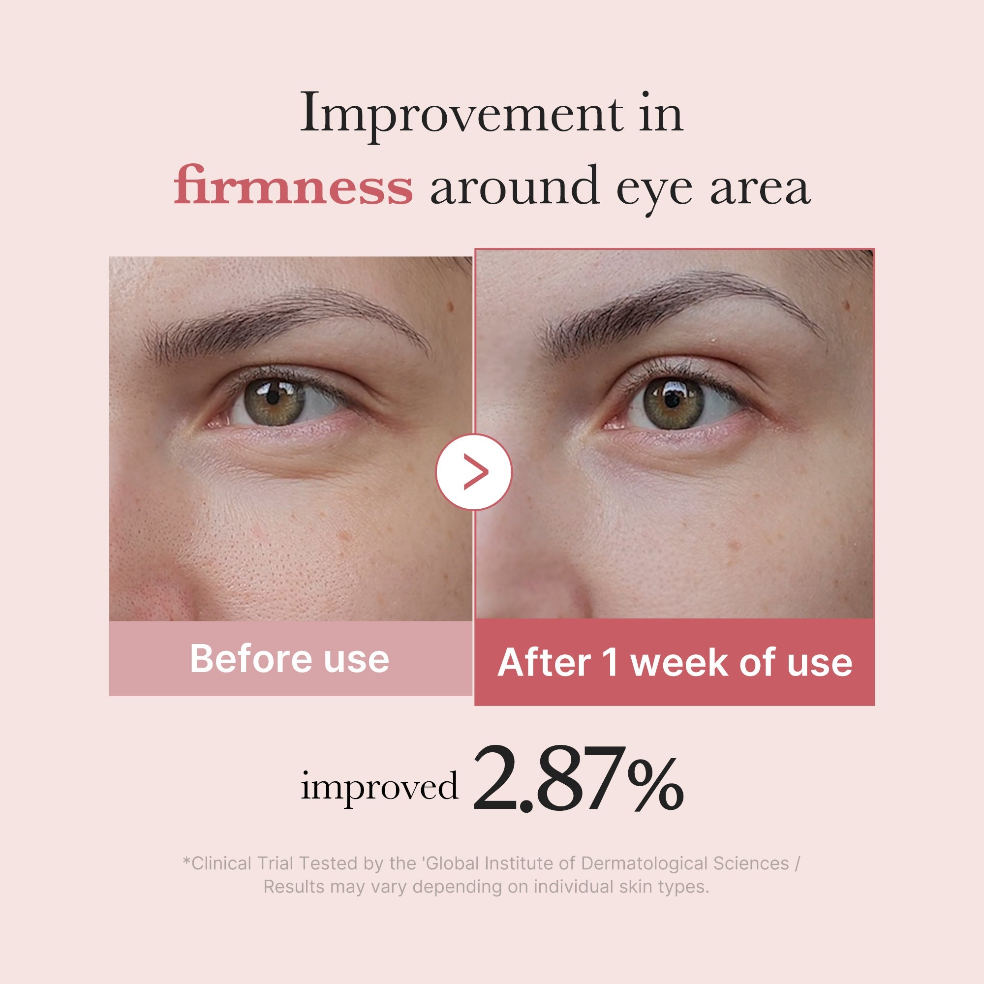 [GIFT] PDRN Pink Peptide Eye Cream - Dewy Body Care