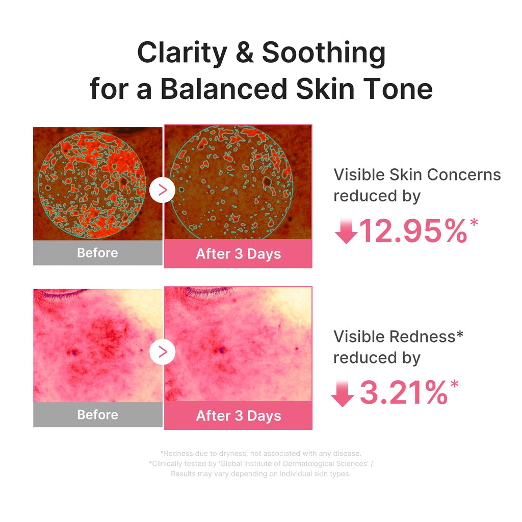 Ultra Light PDRN Pink Peptide Serum - Radiant Pore Care