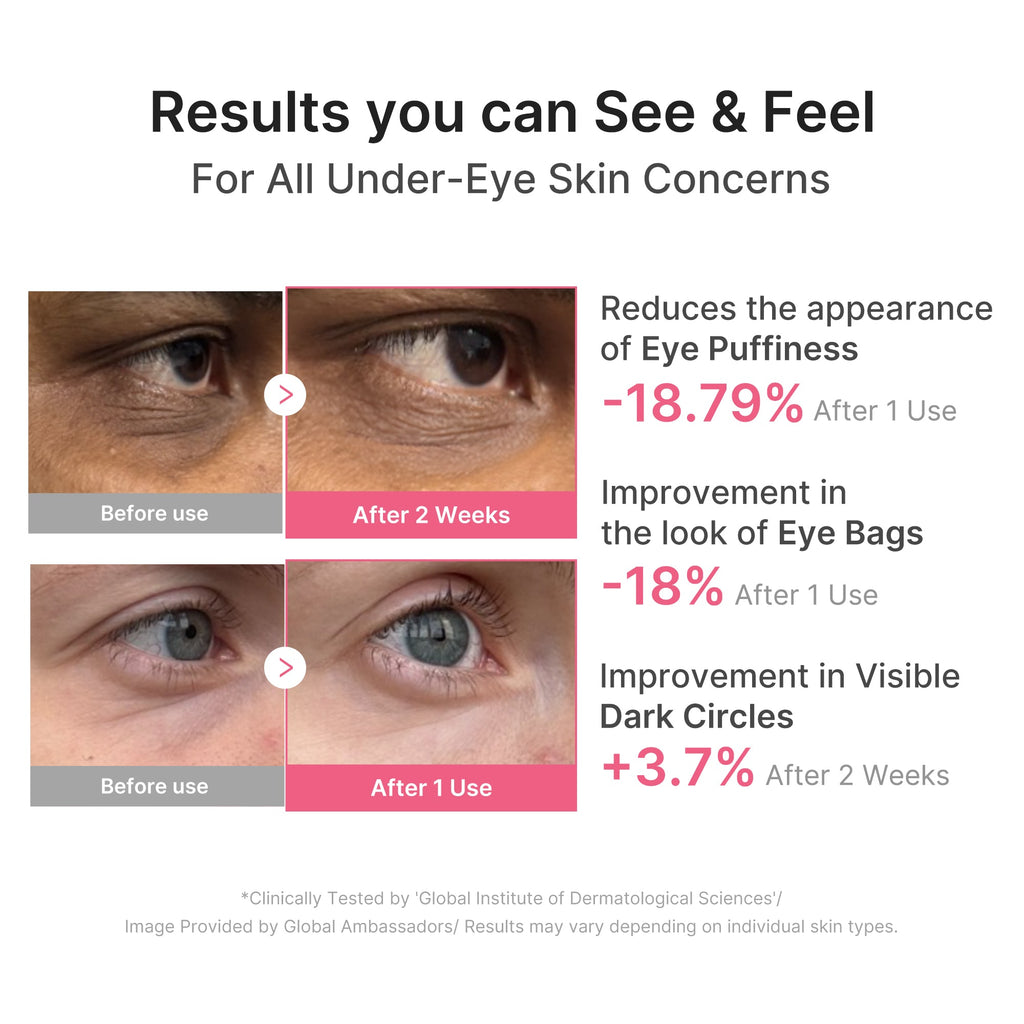 PDRN Caffeine Collagen Eye Patch - Fresh Beauty Tool