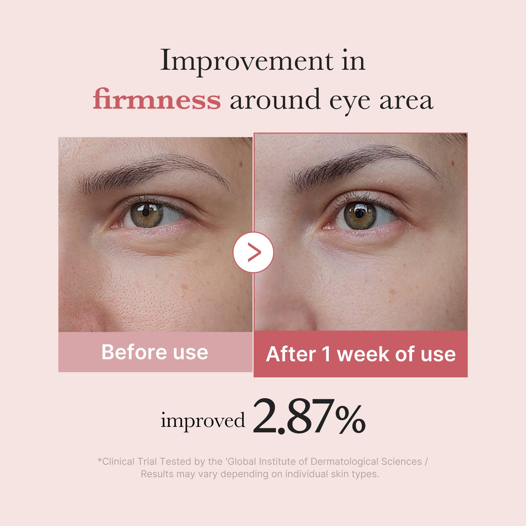 [Subscr.] PDRN Pink Peptide Eye Cream - Fresh Day Lotion