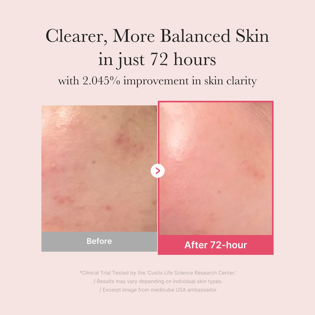 TXA Niacinamide Serum - Routine Ready Clay Mask