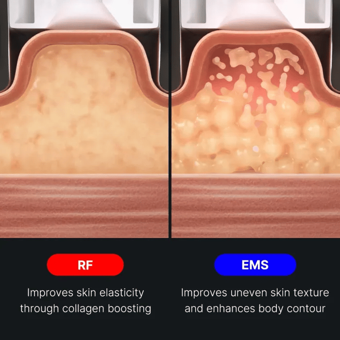 AGE-R Contour Body Shot - Soft Touch Body Care